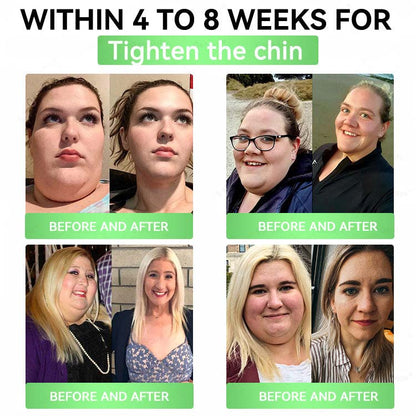 Official Store| 🧑‍⚕️Alcuras™ Moringa × Berberine × AMPK 8-Benefit Slimming & Metabolic Nano Microneedle Patch 🇺🇸  Just once a day · Visible changes in 7 days  ✅ For obesity, loose skin, diabetes, sleep apnea, joint issues, and more