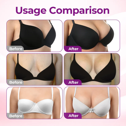 🔥Alcuras® Targeted Breast Enhancement Advanced Nano Microneedle Patch